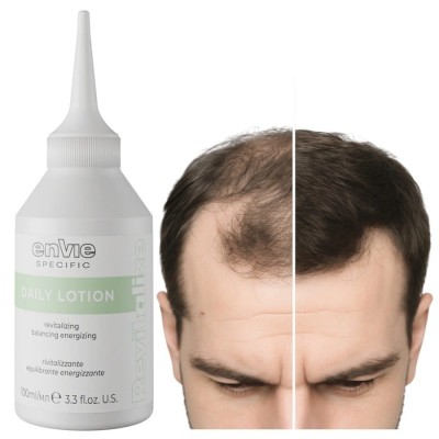 Zdjęcie produktu ENVIE Serum Przeciw wypadaniu włosów, Lotion stymulujący wzrost 100 ml
