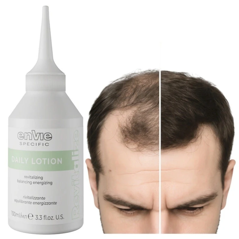 ENVIE Serum Przeciw wypadaniu włosów, Lotion stymulujący wzrost 100 ml